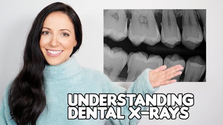 Understanding Cavities: A Visual Guide to X-Ray Analysis