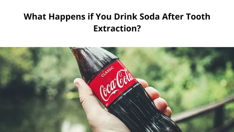 Post-Tooth Extraction: When Can I Drink Soda?